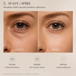 EyeRevive360 Masseur Yeux rotatif